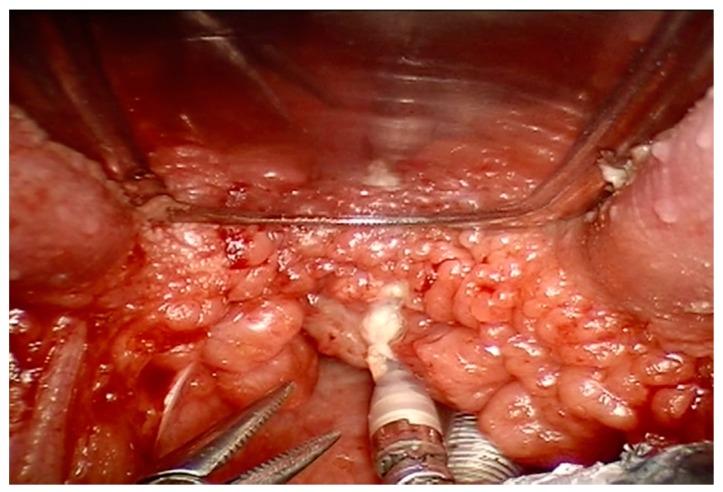 https://cdn.ncbi.nlm.nih.gov/pmc/blobs/d1c5/6765844/c8fd154e9cb5/ijerph-16-03235-g003.jpg