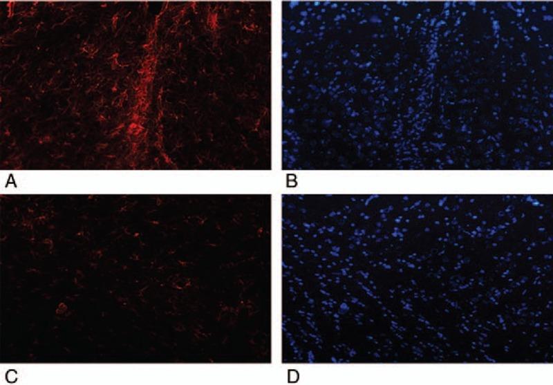 https://cdn.ncbi.nlm.nih.gov/pmc/blobs/d1c6/6200375/994f3fbd9a33/jcrsu-29-1689-g003.jpg