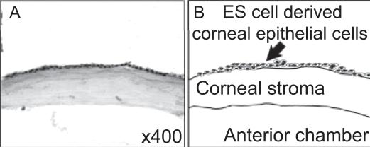 https://cdn.ncbi.nlm.nih.gov/pmc/blobs/d1cb/2704521/592af7c2bff4/opth-1-373f6.jpg