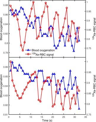 https://cdn.ncbi.nlm.nih.gov/pmc/blobs/d1ce/5363245/07af835f32a1/MRM-77-1399-g008.jpg