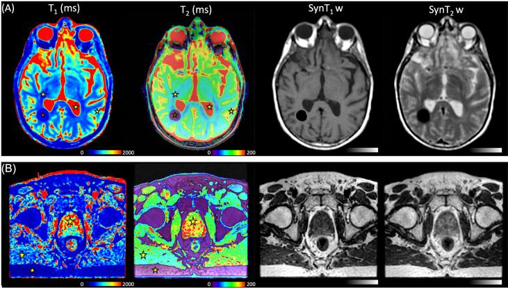 https://cdn.ncbi.nlm.nih.gov/pmc/blobs/d1d4/9065558/c7a82dd8cf58/fonc-12-841761-g007.jpg