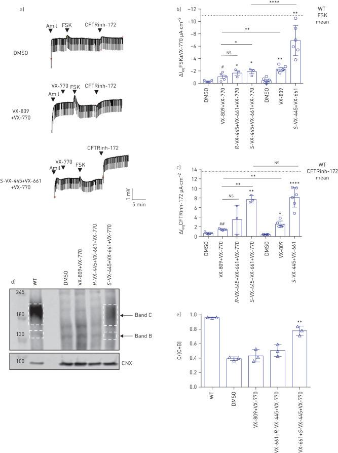 https://cdn.ncbi.nlm.nih.gov/pmc/blobs/d1d5/8209484/f1788989f39d/ERJ-02774-2020.01.jpg