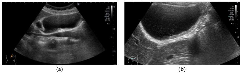 https://cdn.ncbi.nlm.nih.gov/pmc/blobs/d1dd/8145033/015b35d20aa1/diagnostics-11-00784-g002.jpg
