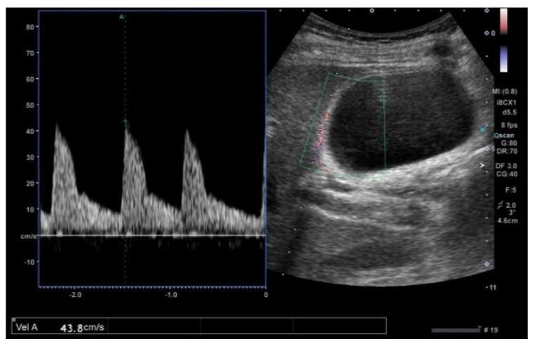 https://cdn.ncbi.nlm.nih.gov/pmc/blobs/d1dd/8145033/38473b4ed7f3/diagnostics-11-00784-g015.jpg