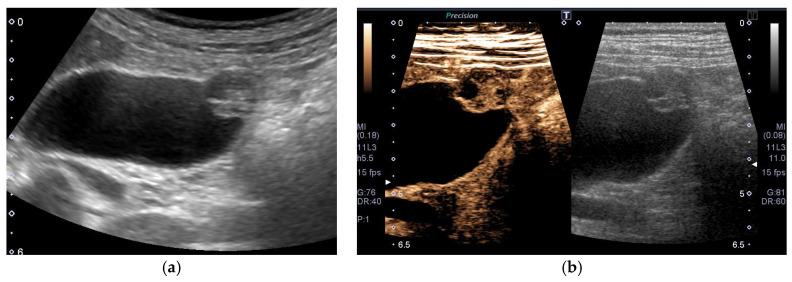 https://cdn.ncbi.nlm.nih.gov/pmc/blobs/d1dd/8145033/8181567e820a/diagnostics-11-00784-g007.jpg