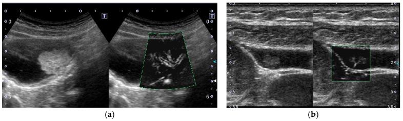 https://cdn.ncbi.nlm.nih.gov/pmc/blobs/d1dd/8145033/c9435a37a73b/diagnostics-11-00784-g010.jpg