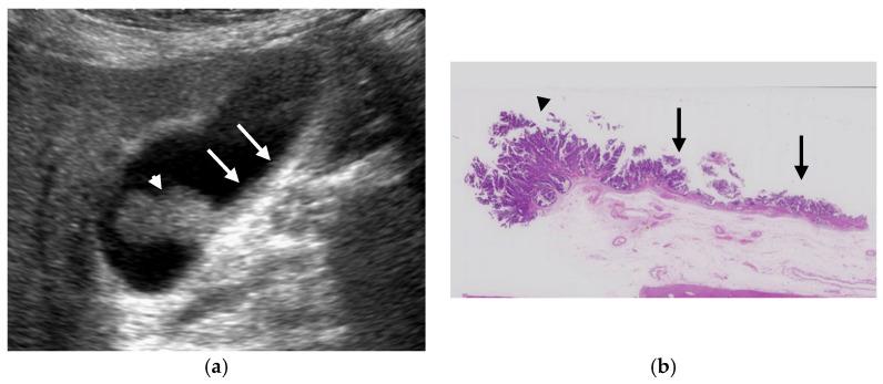 https://cdn.ncbi.nlm.nih.gov/pmc/blobs/d1dd/8145033/e7db1c016081/diagnostics-11-00784-g009.jpg