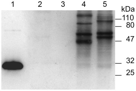 https://cdn.ncbi.nlm.nih.gov/pmc/blobs/d1ea/2935394/4804ff461d88/pntd.0000813.g004.jpg