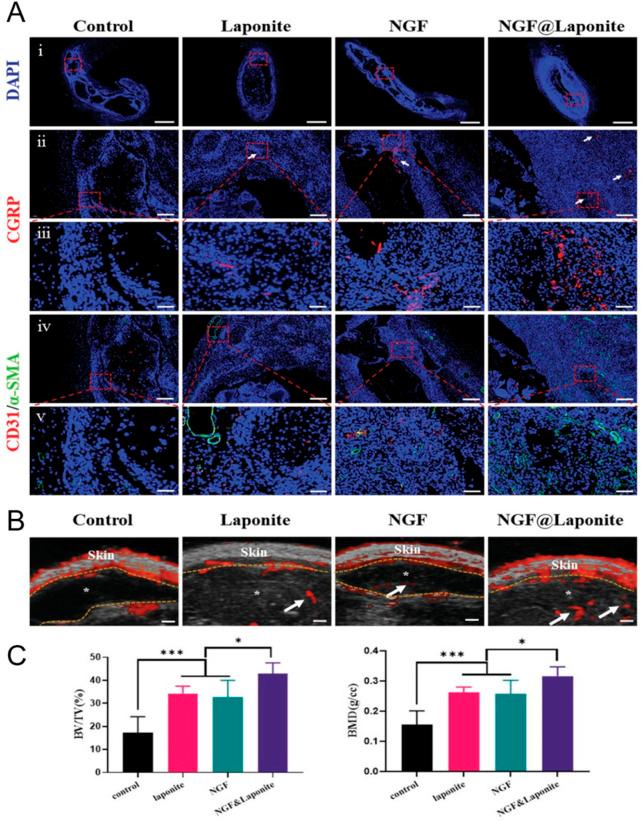 https://cdn.ncbi.nlm.nih.gov/pmc/blobs/d1eb/12177472/c461b3be5ce6/fbioe-13-1506122-g014.jpg