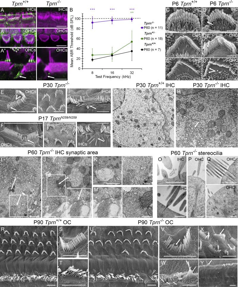 https://cdn.ncbi.nlm.nih.gov/pmc/blobs/d1f7/12240062/9e9ca6777f72/jcb_202408026_fig6.jpg