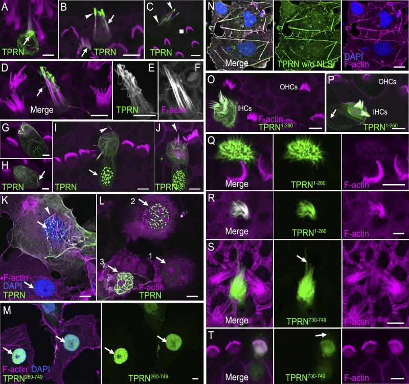 https://cdn.ncbi.nlm.nih.gov/pmc/blobs/d1f7/12240062/ef03b54b2eeb/jcb_202408026_fig2.jpg