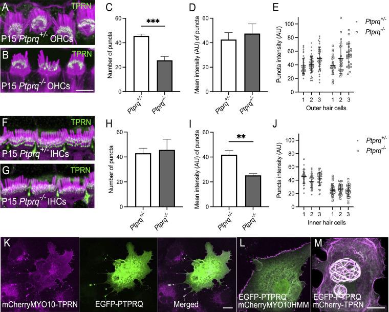 https://cdn.ncbi.nlm.nih.gov/pmc/blobs/d1f7/12240062/f6b593d60c72/jcb_202408026_fig7.jpg