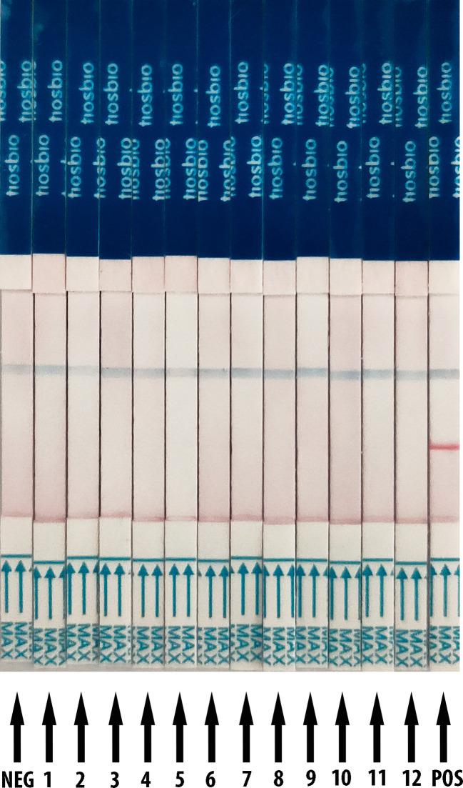 https://cdn.ncbi.nlm.nih.gov/pmc/blobs/d1f8/7882697/9825a64d3079/fcimb-11-613304-g002.jpg