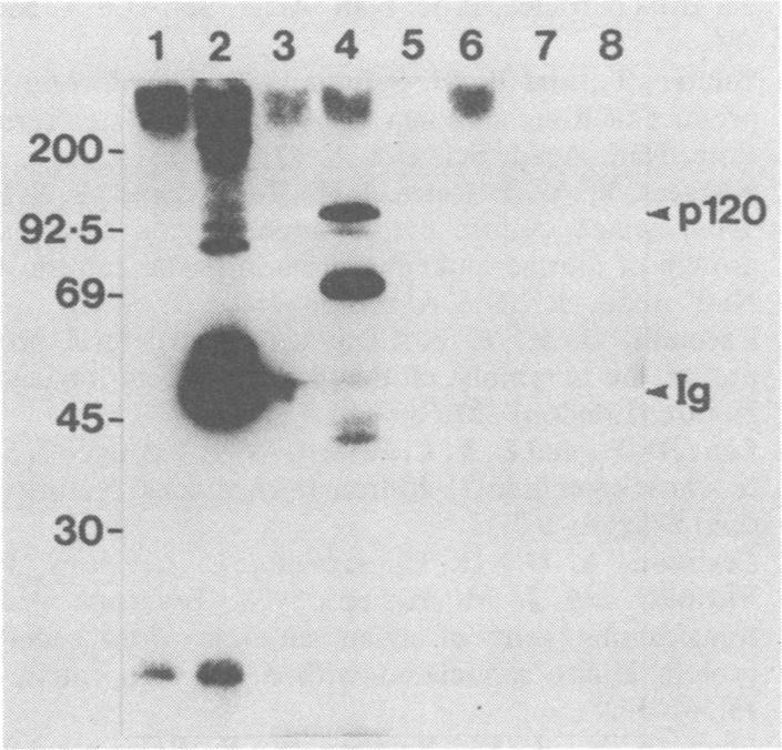 https://cdn.ncbi.nlm.nih.gov/pmc/blobs/d1f9/256051/a01ee5138a39/jvirol00157-0135-a.jpg