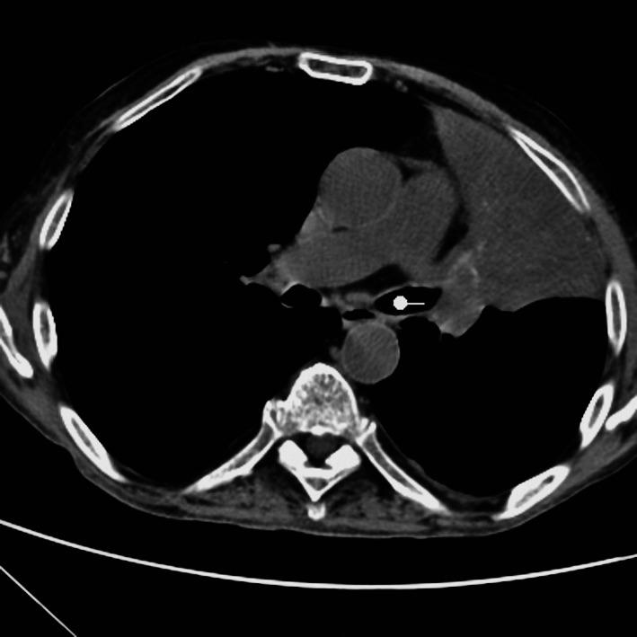 https://cdn.ncbi.nlm.nih.gov/pmc/blobs/d1f9/7808220/72e0d13fc4d4/acc-59-252-f3.jpg