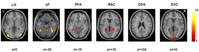 https://cdn.ncbi.nlm.nih.gov/pmc/blobs/d204/7773817/51af2ecc0bac/fnbot-14-597471-g0002.jpg