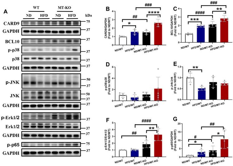 https://cdn.ncbi.nlm.nih.gov/pmc/blobs/d20a/11781176/7cd1707cff04/ijbsv21p1032g006.jpg