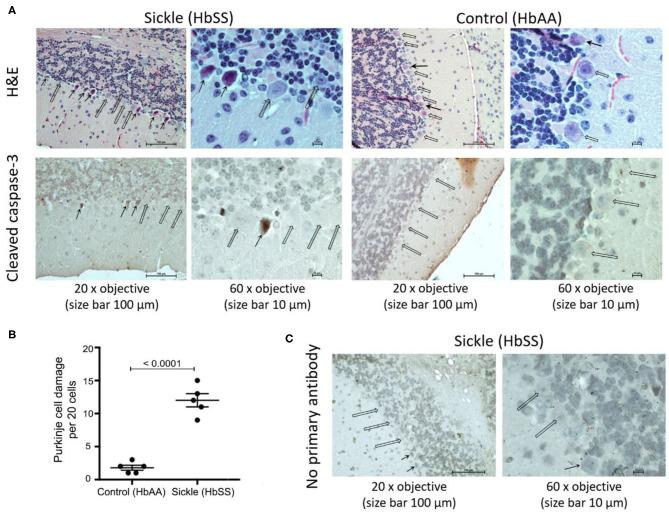 https://cdn.ncbi.nlm.nih.gov/pmc/blobs/d20e/7593487/f5fed18a43b8/fimmu-11-561947-g0001.jpg