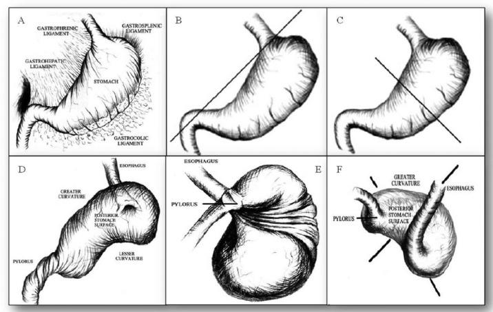 https://cdn.ncbi.nlm.nih.gov/pmc/blobs/d213/4804670/222293460902/10.1177_2333794X14553624-fig2.jpg