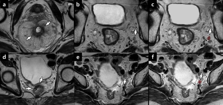 https://cdn.ncbi.nlm.nih.gov/pmc/blobs/d214/12041232/782056e3392d/41598_2025_99029_Fig6_HTML.jpg