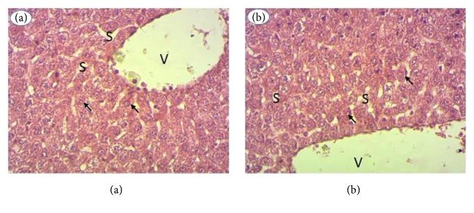https://cdn.ncbi.nlm.nih.gov/pmc/blobs/d214/6633963/66ff8d976153/JT2019-3530659.005.jpg