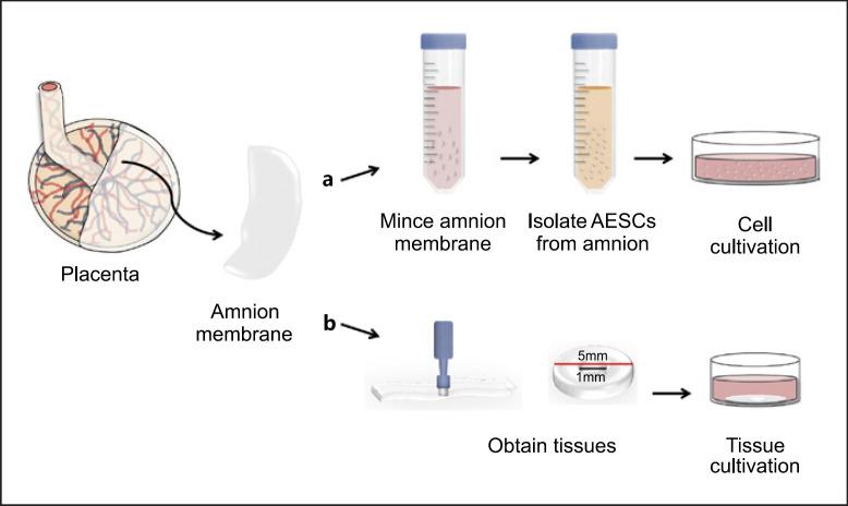 https://cdn.ncbi.nlm.nih.gov/pmc/blobs/d21c/9909721/4e9d30224ecd/goi-0087-0333-g01.jpg
