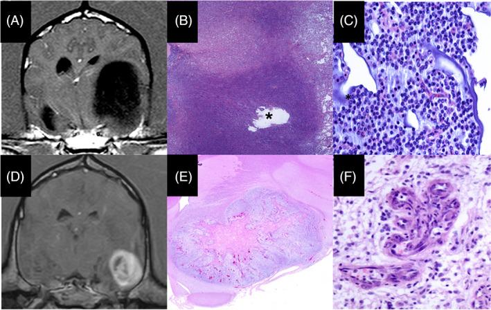 https://cdn.ncbi.nlm.nih.gov/pmc/blobs/d22b/9708455/2752cfd8fdb7/JVIM-36-2104-g001.jpg
