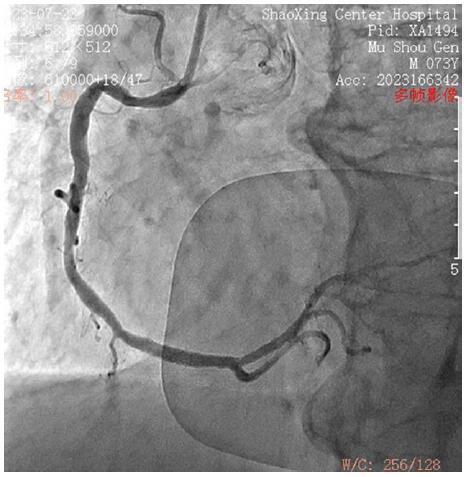https://cdn.ncbi.nlm.nih.gov/pmc/blobs/d22d/12187265/14f18c6b4878/medi-104-e42917-g006.jpg