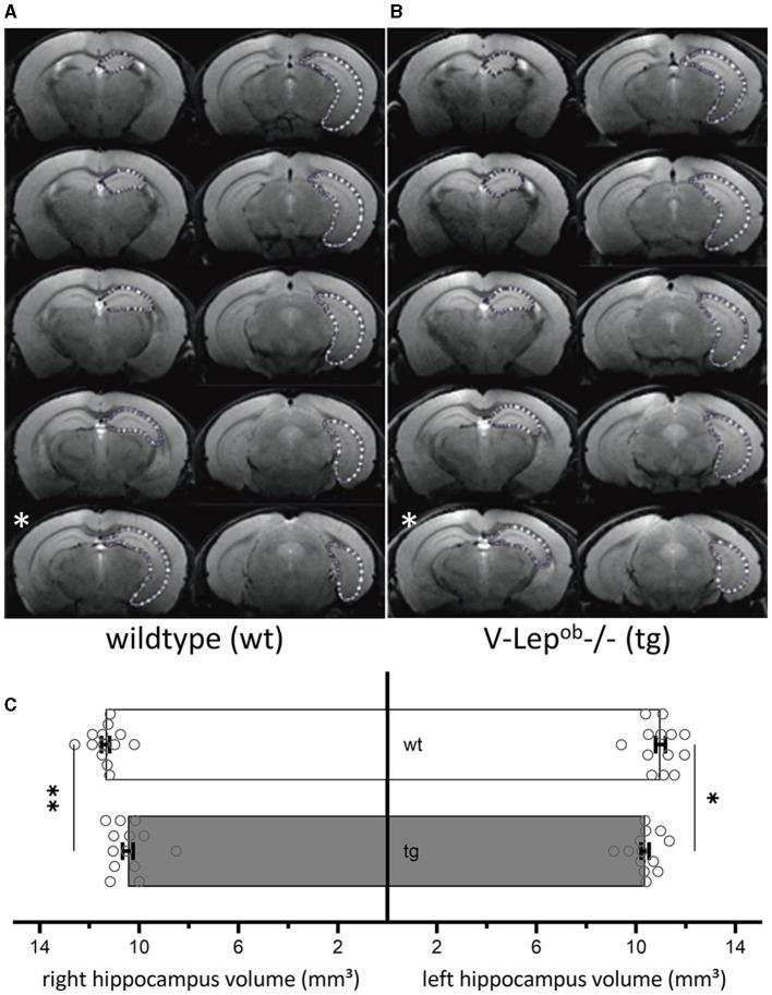 https://cdn.ncbi.nlm.nih.gov/pmc/blobs/d22e/11224464/62ba125c5058/fnagi-16-1373477-g0001.jpg