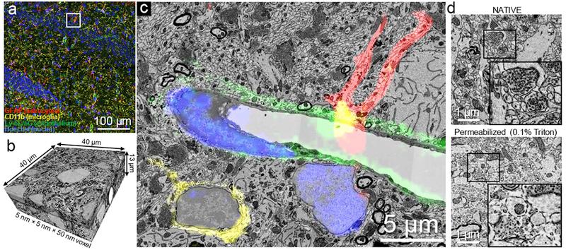 https://cdn.ncbi.nlm.nih.gov/pmc/blobs/d231/6405223/4398c8aedf95/nihms-1507655-f0002.jpg