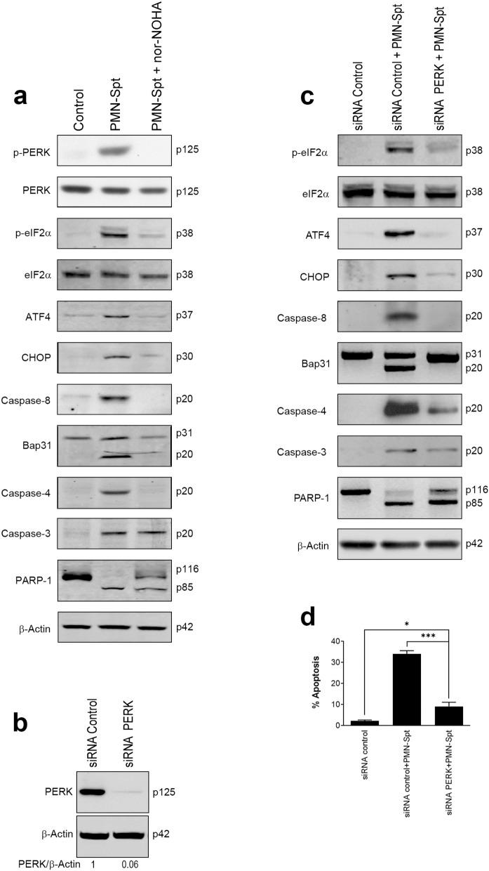 https://cdn.ncbi.nlm.nih.gov/pmc/blobs/d235/8206108/1ac4d6a4eadf/41598_2021_91947_Fig6_HTML.jpg