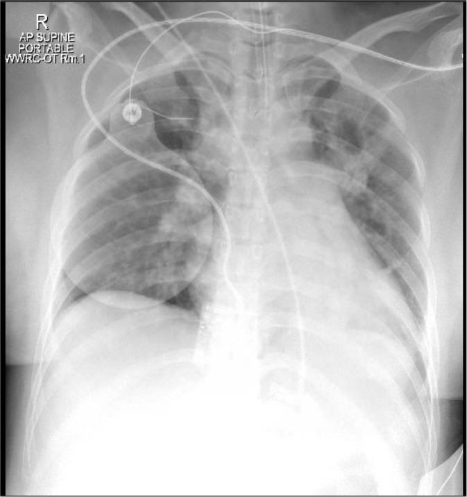 https://cdn.ncbi.nlm.nih.gov/pmc/blobs/d23e/10376761/2d3877886144/qmj-2023-01-013-g004.jpg