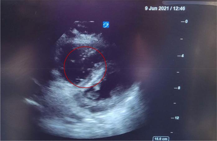 https://cdn.ncbi.nlm.nih.gov/pmc/blobs/d23e/10376761/5cbb2df1f499/qmj-2023-01-013-g003.jpg