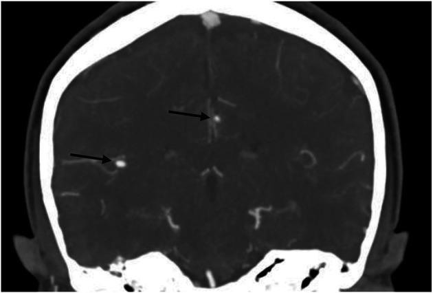 https://cdn.ncbi.nlm.nih.gov/pmc/blobs/d24a/10461712/bdd2abf85f88/NXG-2023-000112f1.jpg