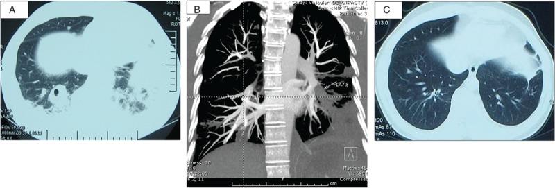 https://cdn.ncbi.nlm.nih.gov/pmc/blobs/d24b/4998308/582958361d11/medi-95-e3846-g002.jpg