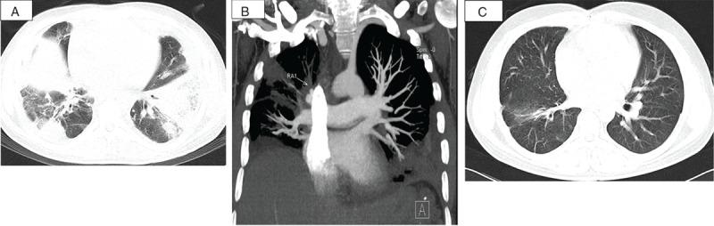https://cdn.ncbi.nlm.nih.gov/pmc/blobs/d24b/4998308/81bd07f194aa/medi-95-e3846-g003.jpg