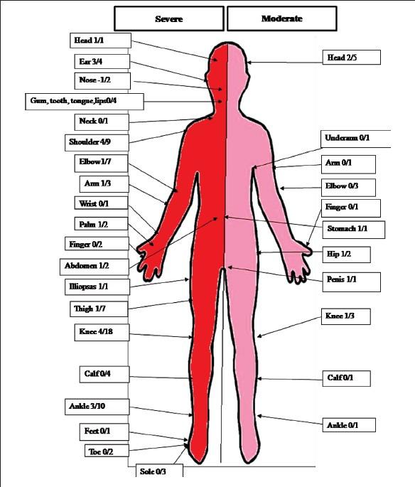 https://cdn.ncbi.nlm.nih.gov/pmc/blobs/d25c/4181156/a2f670c2eda3/IJMR-140-19-g003.jpg