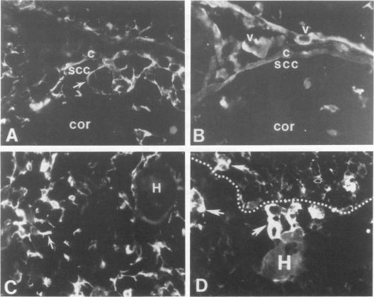 https://cdn.ncbi.nlm.nih.gov/pmc/blobs/d269/1880765/b7358616e847/amjpathol00132-0165-a.jpg