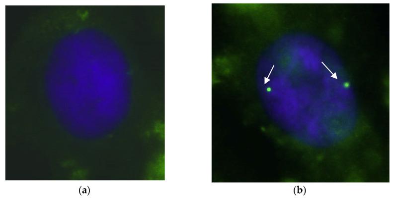https://cdn.ncbi.nlm.nih.gov/pmc/blobs/d26d/10669464/79d9b4c66caf/biomedicines-11-03071-g007.jpg