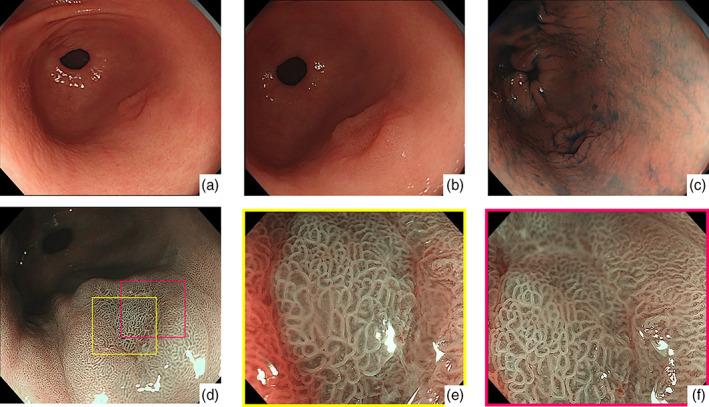 https://cdn.ncbi.nlm.nih.gov/pmc/blobs/d26e/8035464/700df5b3cb63/JGH3-5-470-g003.jpg