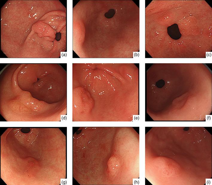 https://cdn.ncbi.nlm.nih.gov/pmc/blobs/d26e/8035464/71756f7df628/JGH3-5-470-g004.jpg