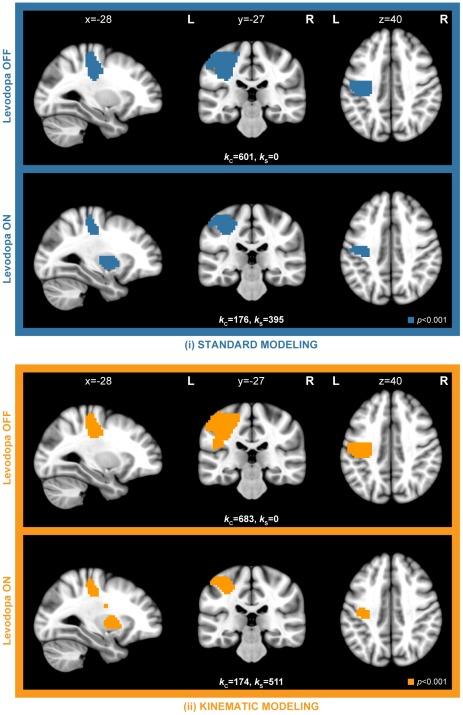 https://cdn.ncbi.nlm.nih.gov/pmc/blobs/d272/3341369/ff4bc1c50966/pone.0036271.g003.jpg