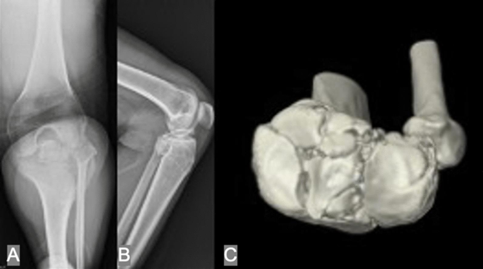 https://cdn.ncbi.nlm.nih.gov/pmc/blobs/d274/10286469/853799323a0d/13018_2023_3938_Fig1_HTML.jpg