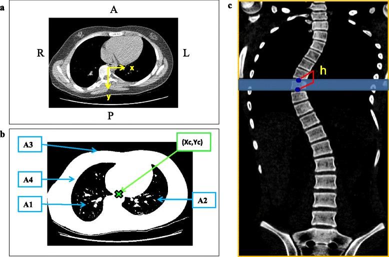 https://cdn.ncbi.nlm.nih.gov/pmc/blobs/d27d/4682283/103016a129e9/13013_2015_60_Fig1_HTML.jpg