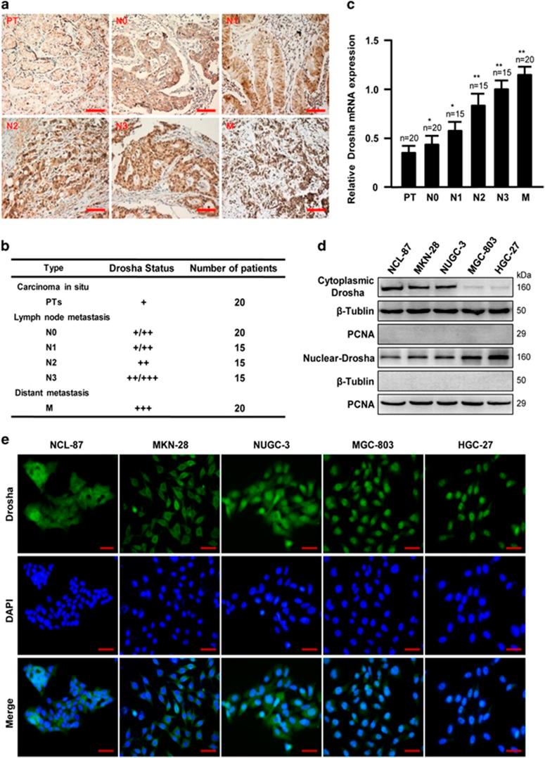 https://cdn.ncbi.nlm.nih.gov/pmc/blobs/d281/5386557/0f93056740e4/cddis20175f1.jpg