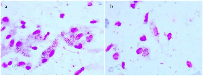 https://cdn.ncbi.nlm.nih.gov/pmc/blobs/d283/12264162/590cd0a74f5d/41598_2025_2107_Fig6_HTML.jpg