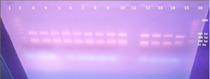 https://cdn.ncbi.nlm.nih.gov/pmc/blobs/d283/12264162/a2cde1b35e20/41598_2025_2107_Fig5_HTML.jpg