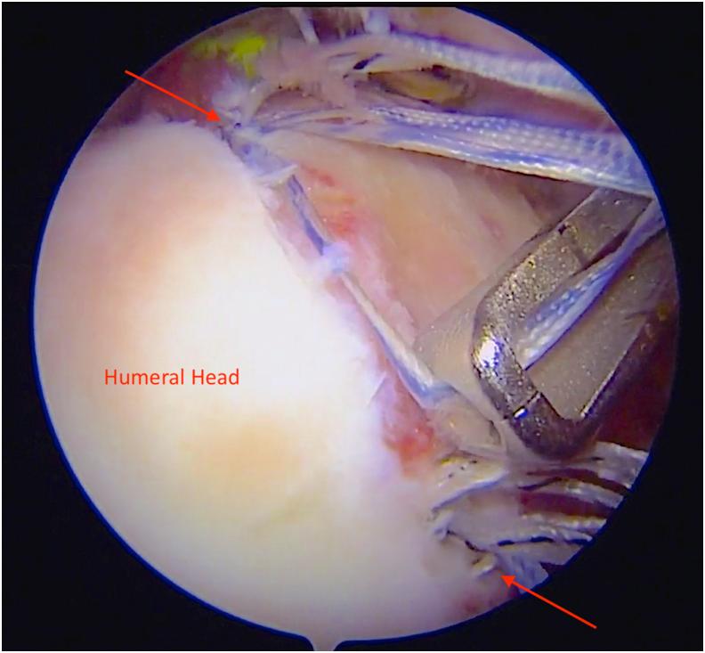 https://cdn.ncbi.nlm.nih.gov/pmc/blobs/d286/8322624/c76fb15a533e/gr2.jpg