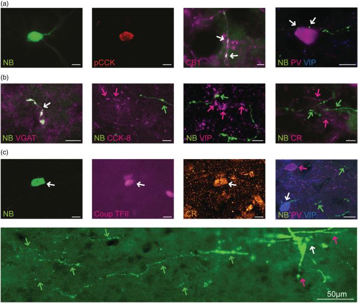 https://cdn.ncbi.nlm.nih.gov/pmc/blobs/d287/9314076/fe2400b9bccc/EJN-55-1409-g006.jpg