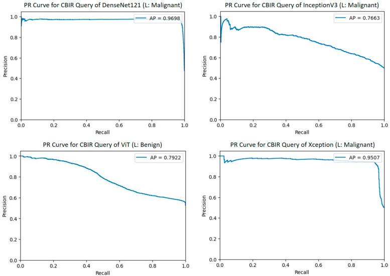 https://cdn.ncbi.nlm.nih.gov/pmc/blobs/d28c/12346797/dbdf2bb341b2/diagnostics-15-01928-g012.jpg